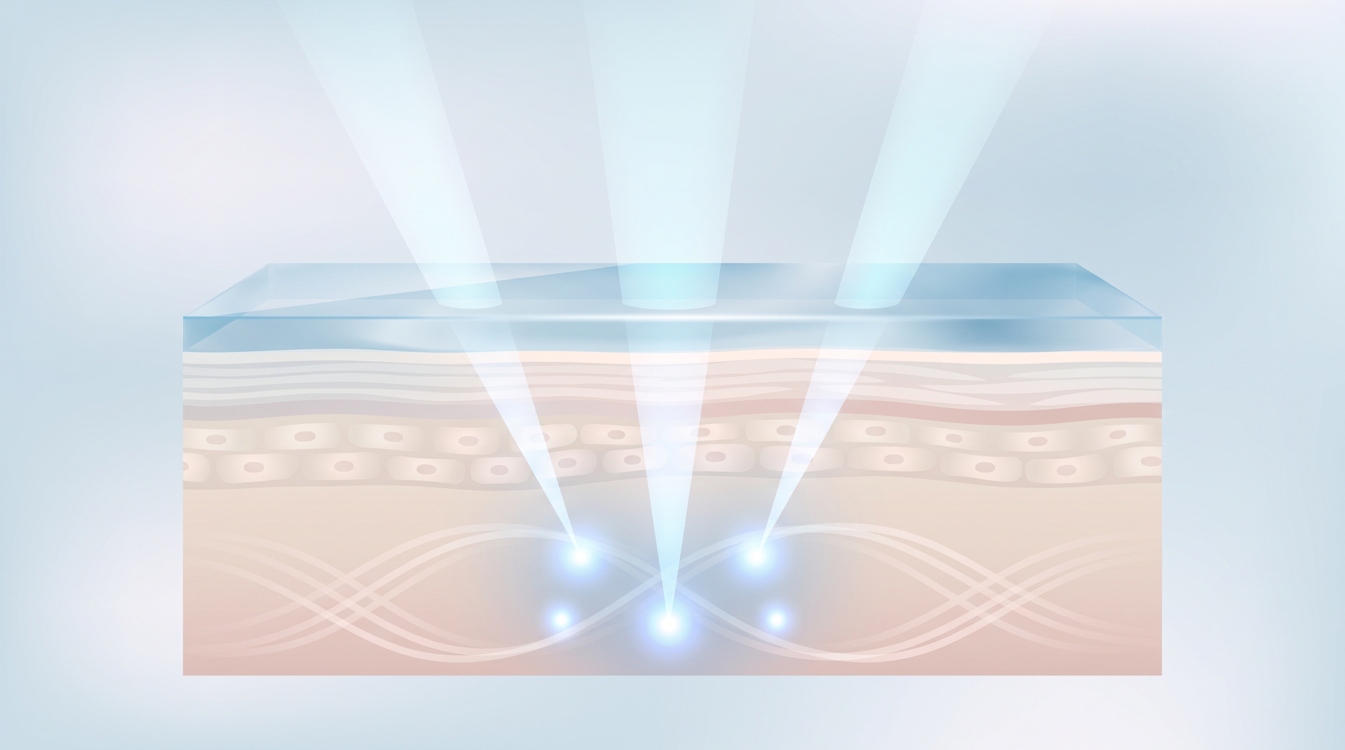 Illustrated cross-section of skin layers with cone-shaped light beams converging to focal points in the deeper dermis beneath a cool blue translucent surface layer